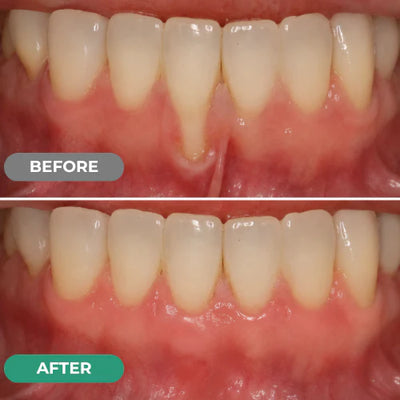 Souvo Gel